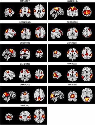 Aberrant inter-network functional connectivity in drug-naive Parkinson’s disease patients with tremor dominant and postural instability and gait difficulty